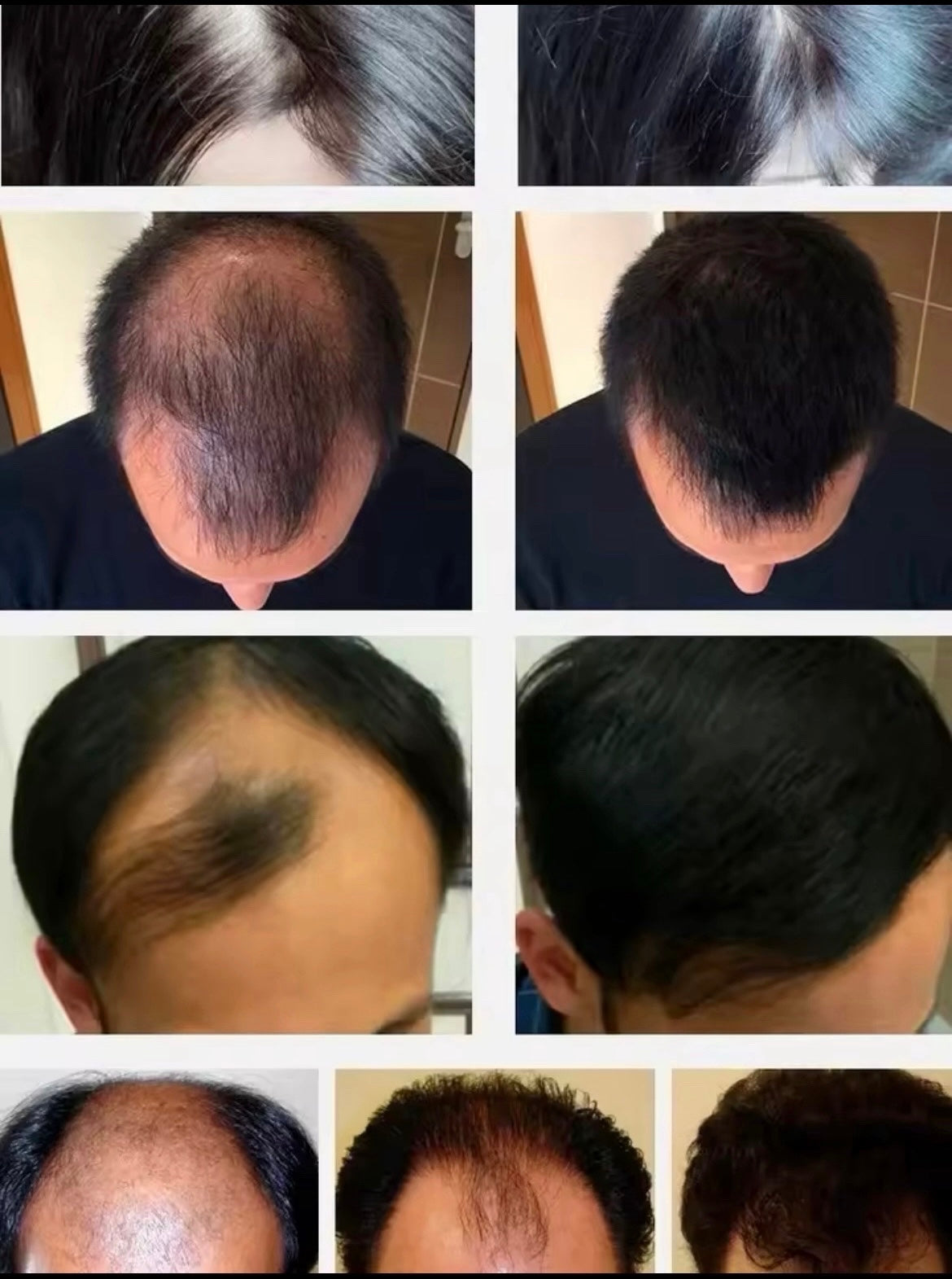 SERUM INDIAN HAIR GROWTH OIL GALLON