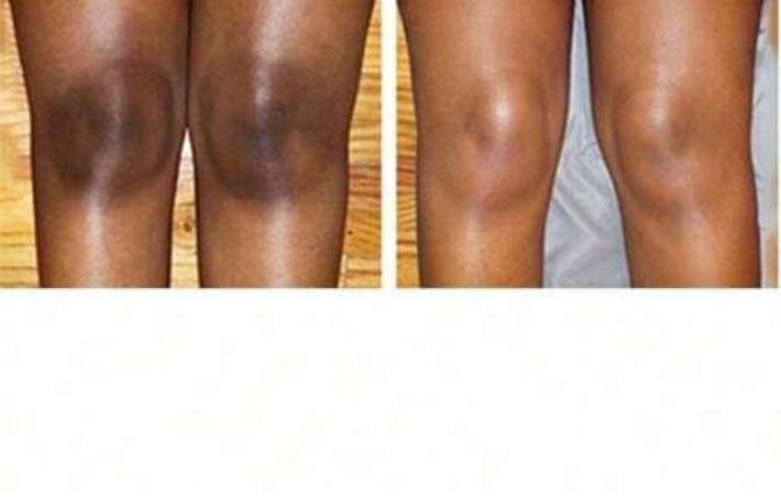 SKIN WHITENING BODY LOTION