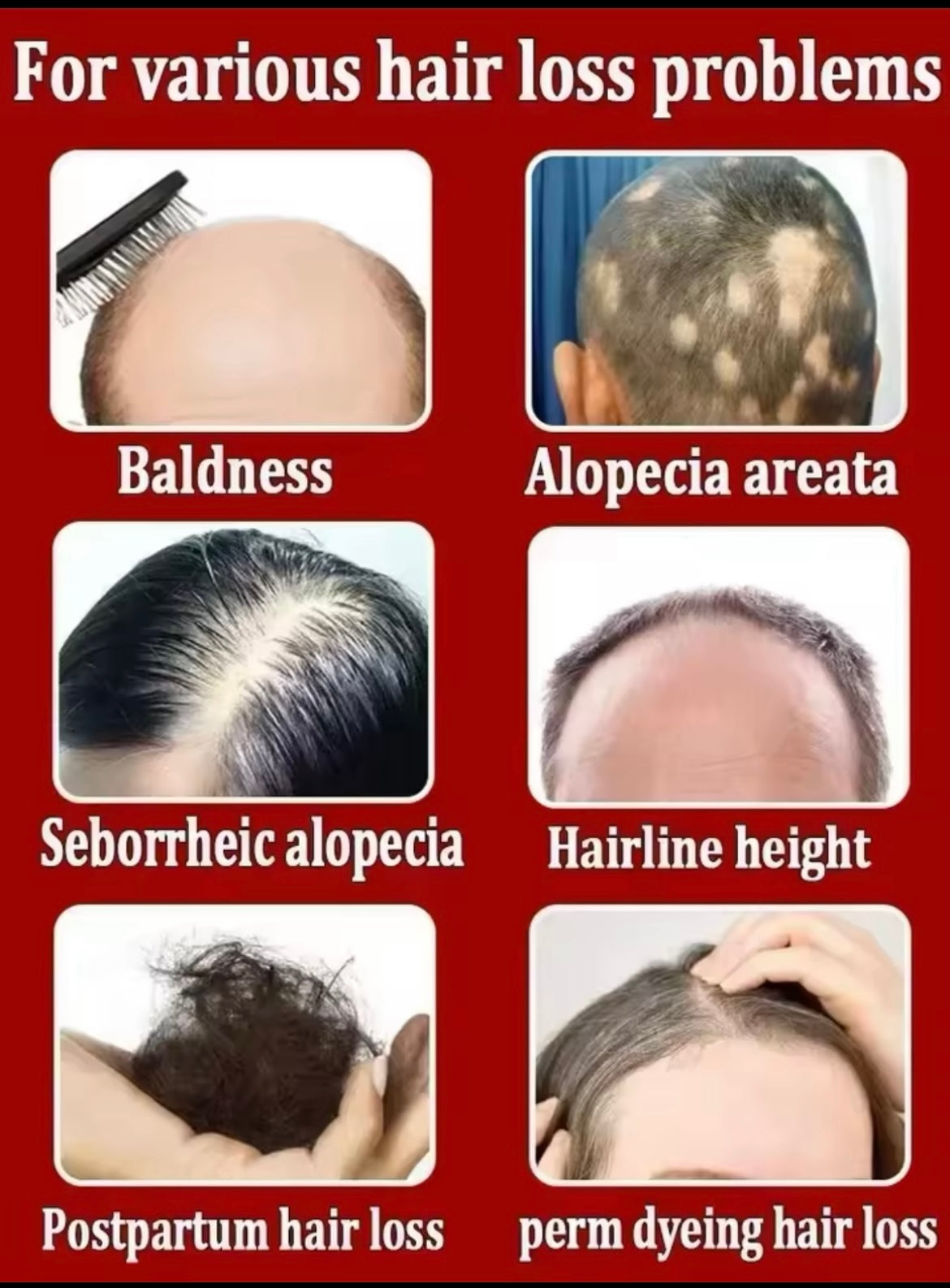 SERUM INDIAN HAIR GROWTH OIL GALLON