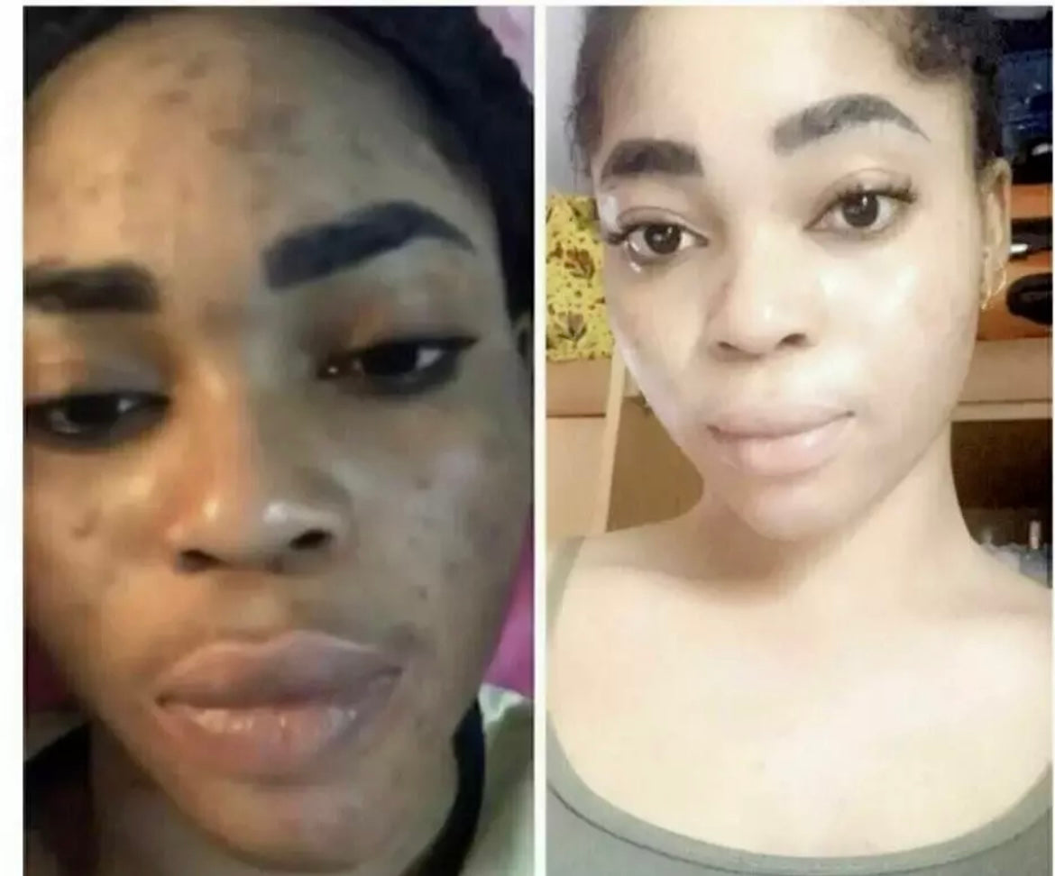 SKIN WHITENING FACE CREAM