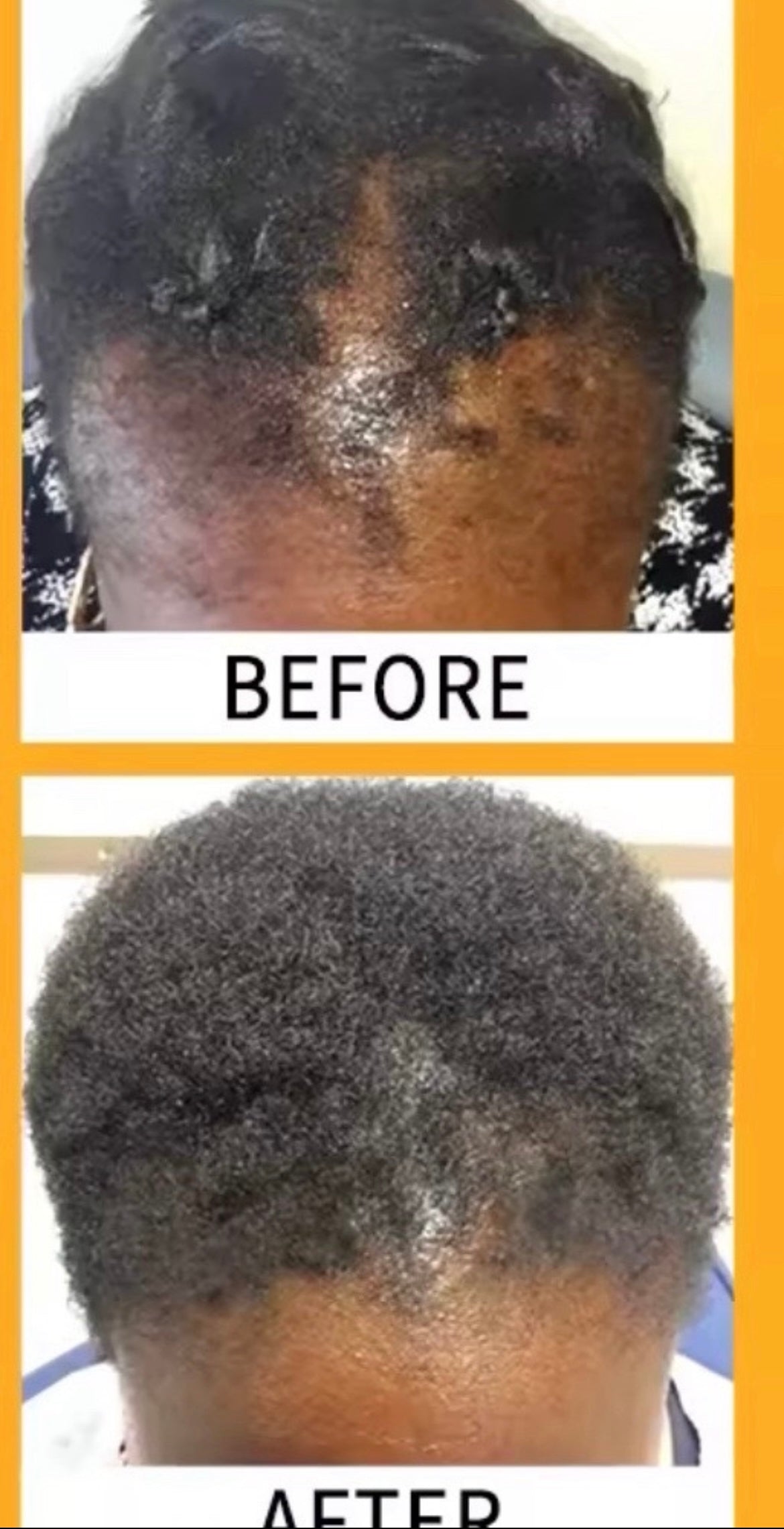 SERUM INDIAN HAIR GROWTH OIL GALLON